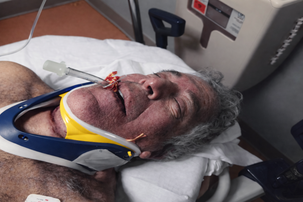 Jeffrey Epstein durante el procedimiento de autopsia