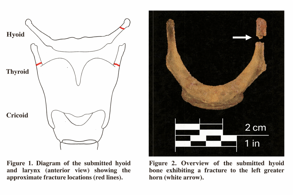 Imagen del examen oficial que determinó la causa de su muerte bajo custodia federal.