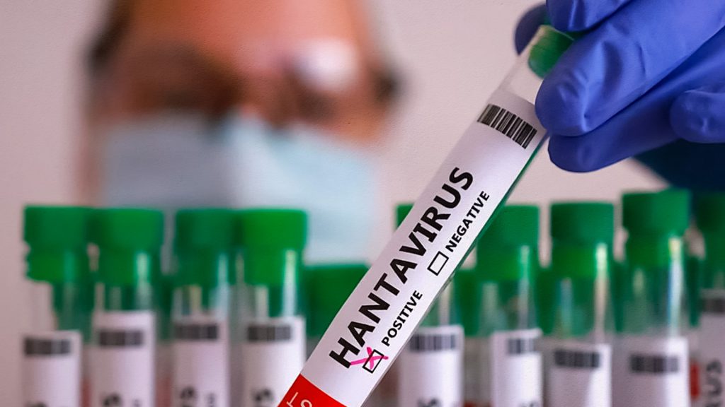 España confirma primer caso sospechoso de hantavirus vinculado al crucero MV Hondius