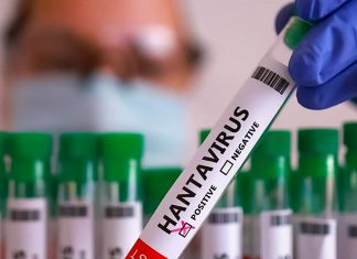 España e Israel detectan primeros casos de hantavirus España confirma primer caso sospechoso de hantavirus vinculado al crucero MV Hondius