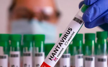 España e Israel detectan primeros casos de hantavirus España confirma primer caso sospechoso de hantavirus vinculado al crucero MV Hondius