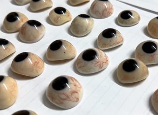 Víctimas de Gaza que perdieron sus ojos reciben prótesis oculares Médicos enfrentan escasez de recursos mientras aumenta la demanda de atención especializada