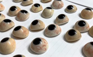 Víctimas de Gaza que perdieron sus ojos reciben prótesis oculares Médicos enfrentan escasez de recursos mientras aumenta la demanda de atención especializada