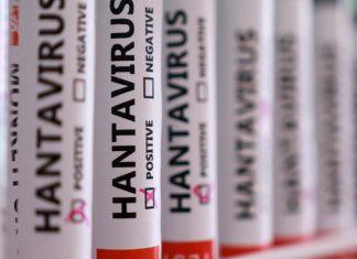 Argentina reporta aumento de casos de hantavirus y alta mortalidad Hantavirus deja alta mortalidad y alerta sanitaria en Argentina