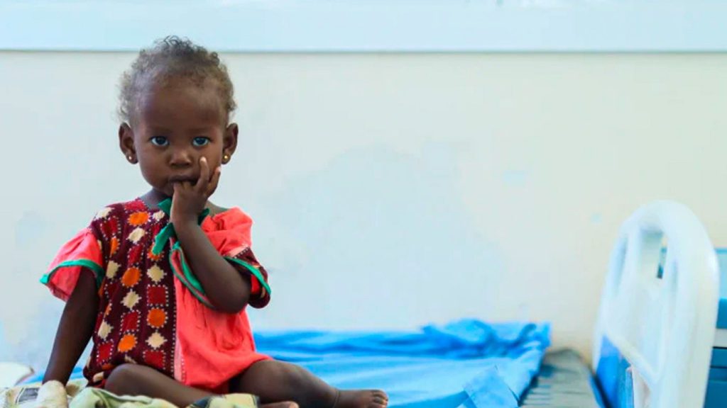 Niña en centro de salud ante crisis de desnutrición infantil en Somalia