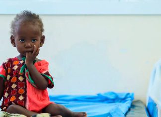 1,9 millones de niños podrían sufrir desnutrición en Somalia Niña en centro de salud ante crisis de desnutrición infantil en Somalia