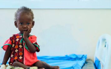 1,9 millones de niños podrían sufrir desnutrición en Somalia Niña en centro de salud ante crisis de desnutrición infantil en Somalia